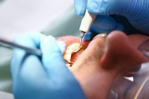 Best After-Hours Dental Care in Gate City, VA