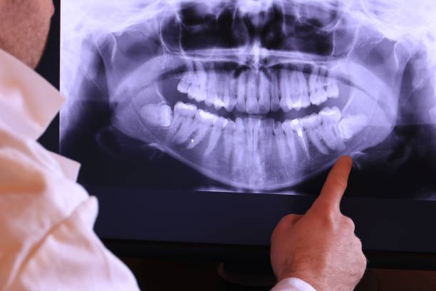 Best Broken or Chipped Tooth Repair in Gate City, VA
